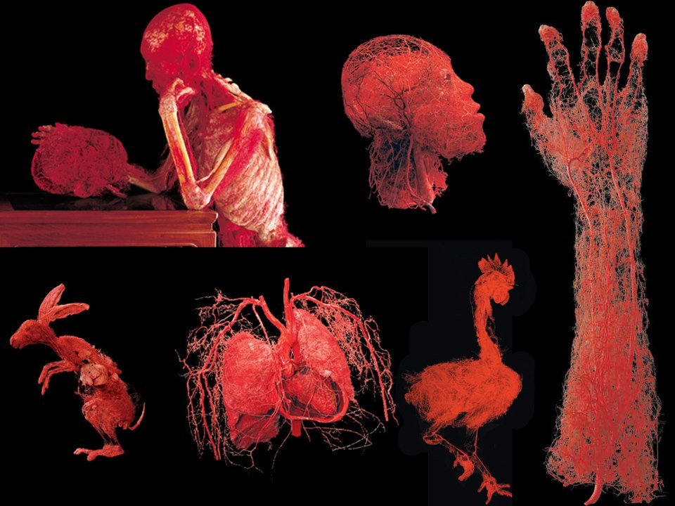 Wystawa BODY WORLDS powraca do Katowic z nową ekspozycją!