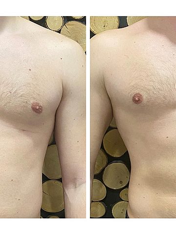 Efekty treningu EMS Efekty treningu EMS