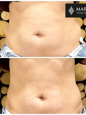 Trening EMS efekty Trening EMS efekty