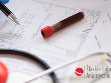 Byt ť LA Nie czekaj zbadaj si Ž ľ Byt ť LA Nie czekaj zbadaj si Ž ľ